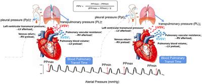 PPV May Be a Starting Point to Achieve Circulatory Protective Mechanical Ventilation